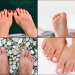 picture of feet